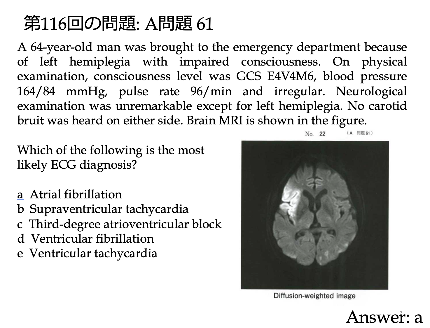 医師国家試験の医学英語関連問題集 English questions from the